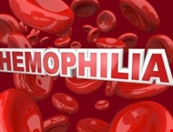 Tài liệu "Hemophilia minh họa bằng hình ảnh"